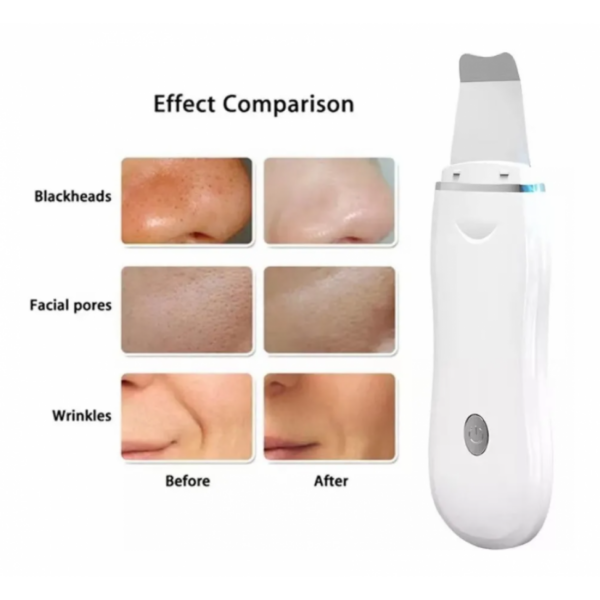 Espátula Facial Ultrasónica Peeling Skin Scrubber Recargable 18065 - Imagen 6